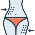 Emtone Cellulite Reduction Bountiful Utah